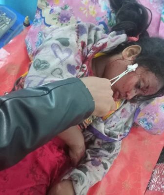 Bangladeshi Child Killed by Cross-Border Stray Gunfire from Clashes Inside Myanmar